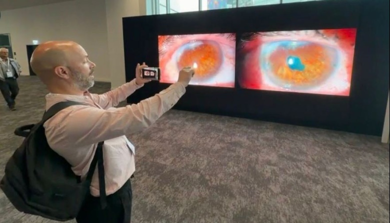 Un médico platense fue reconocido en Londres por una innovadora técnica oftalmológica